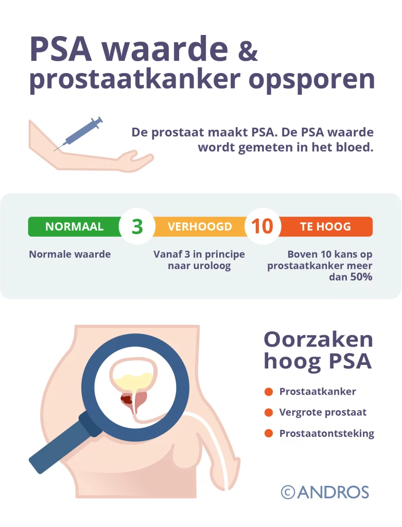 Prostaatkanker Opsporen door PSA Waarde te meten in het bloed. Bij te hoge waarde, boven 10, is de kans op prostaatkanker meer dan 50%